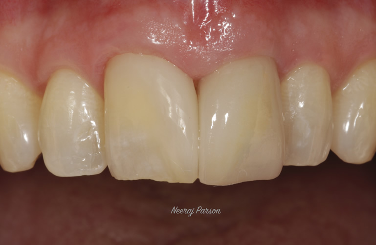 cosmetic dentistry in salisbury