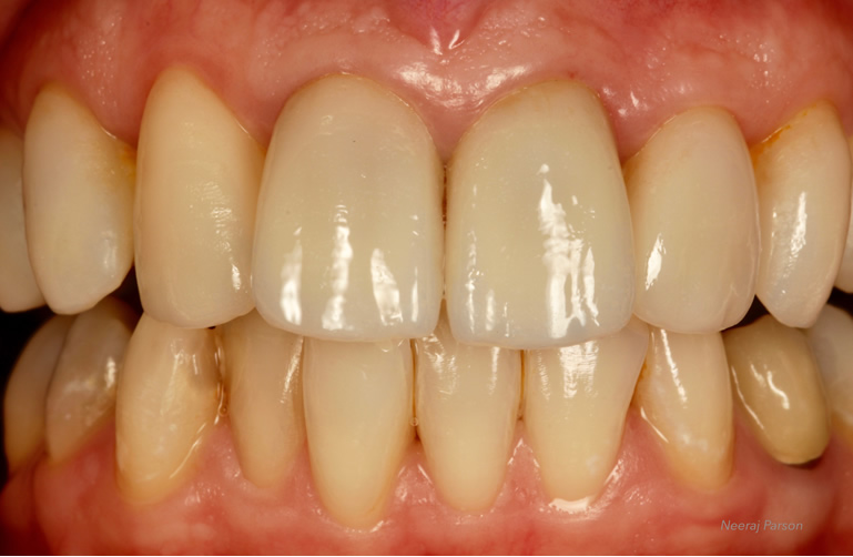 cosmetic dentistry treatment in salisbury