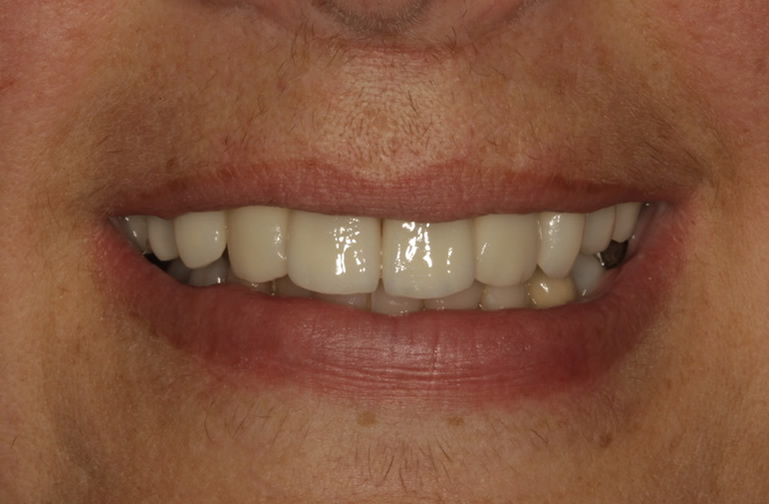 cosmetic dentistry treatment salisbury