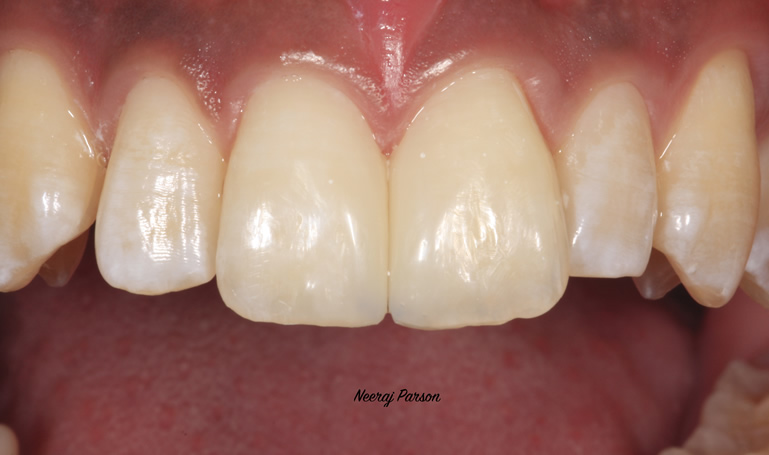 cosmetic dentistry services in salisbury