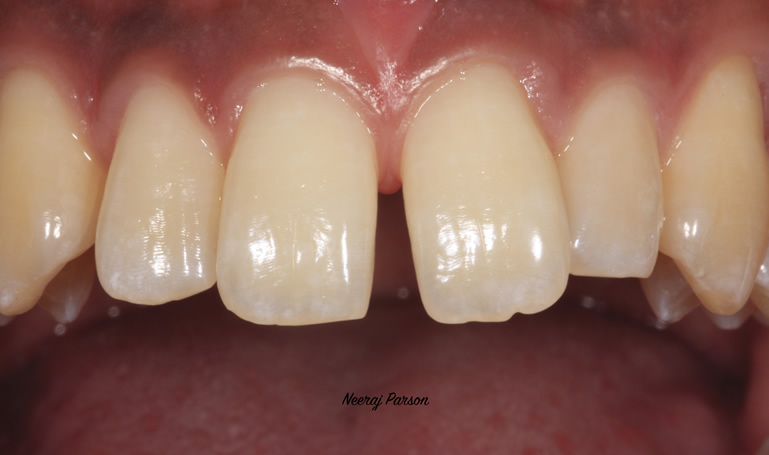 cosmetic dentistry services salisbury